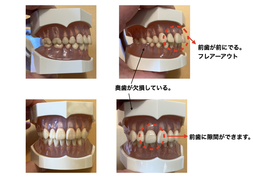 心斎橋　歯医者　歯科技工士が歯の色調と形態を再現する