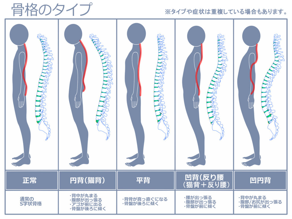 骨格タイプのイラスト