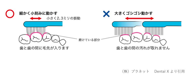 心斎橋　歯医者　歯磨きの強さとストロークの確認する