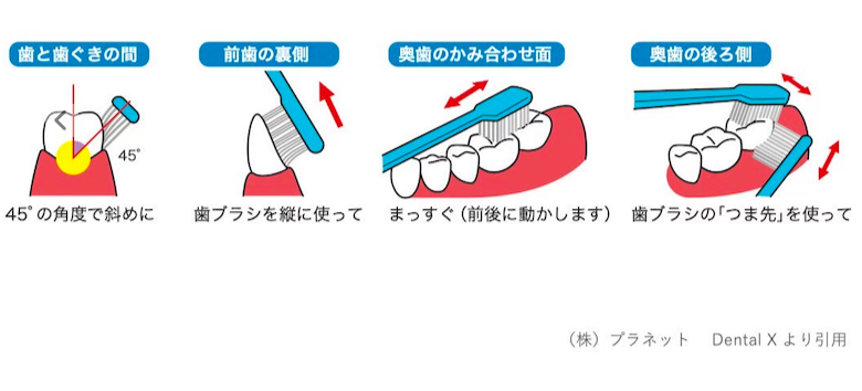 心斎橋　歯医者　③歯ブラシの当たっている場所を意識する