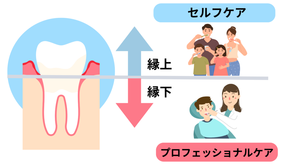 歯周病治療をすると血糖値が下がるか