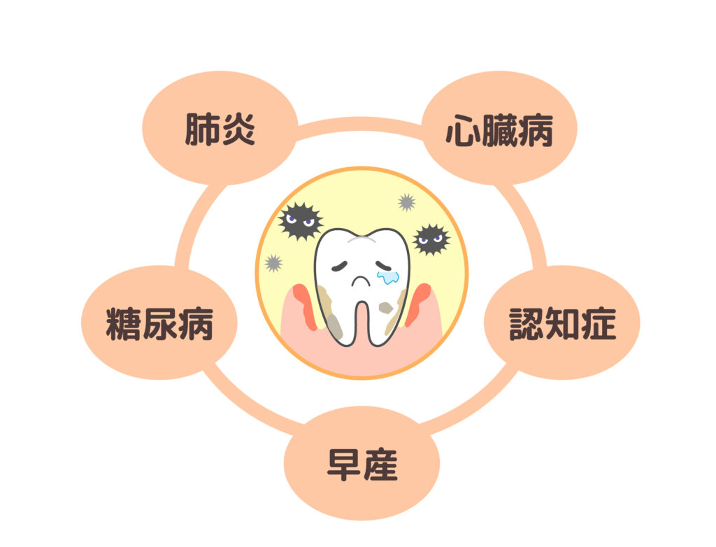 歯周病と全身の健康関係