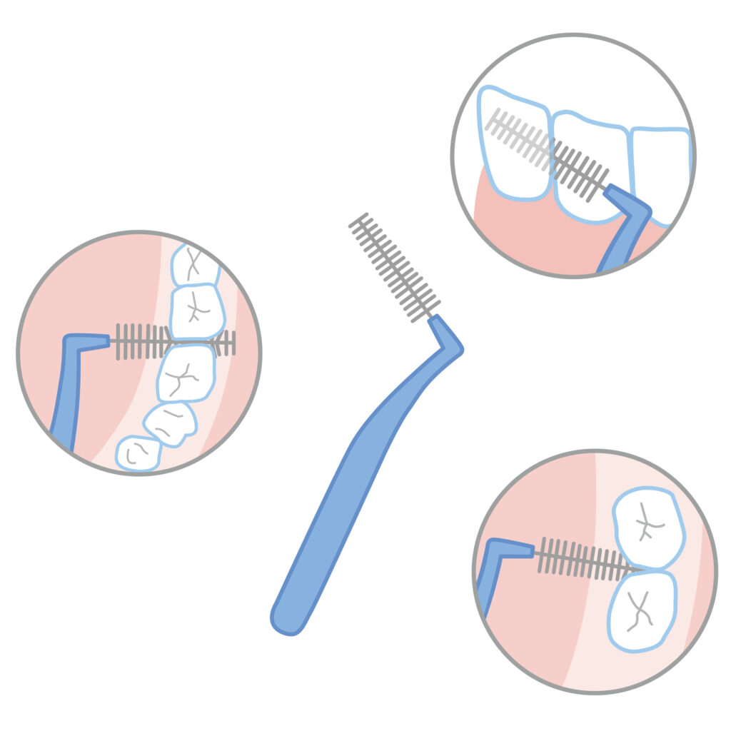 歯間ブラシ