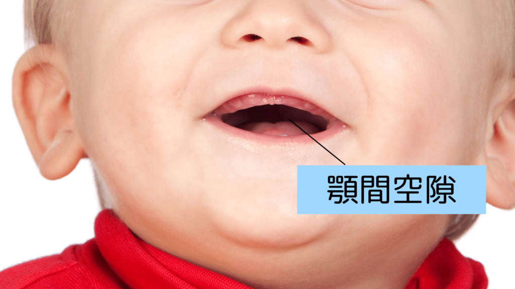 顎間空隙
