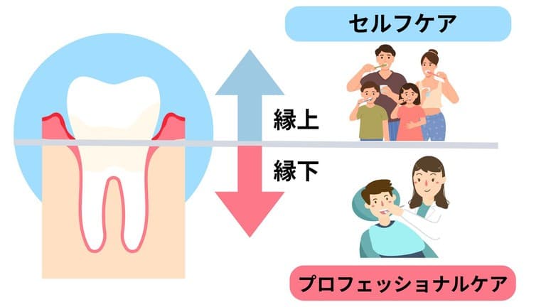 歯のメンテナンスのイメージ