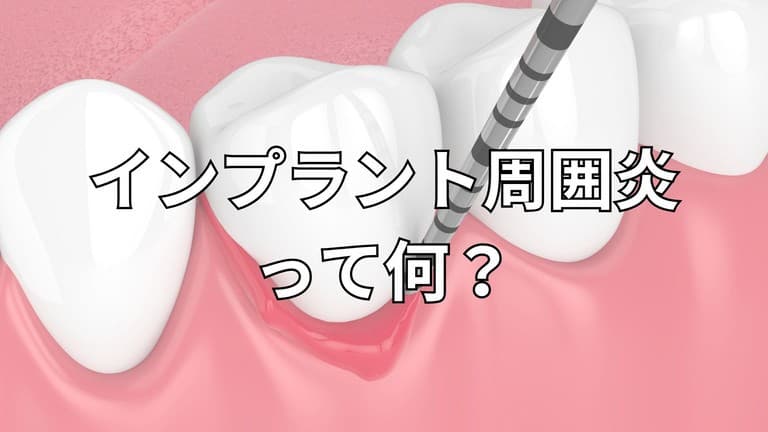 インプラント歯周炎になった歯茎