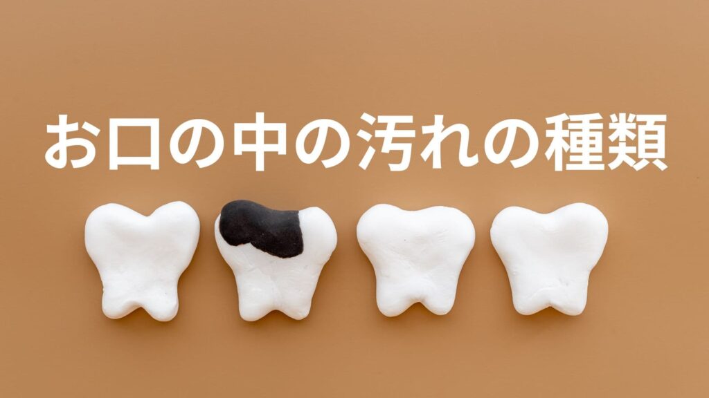 お口の中の汚れの種類