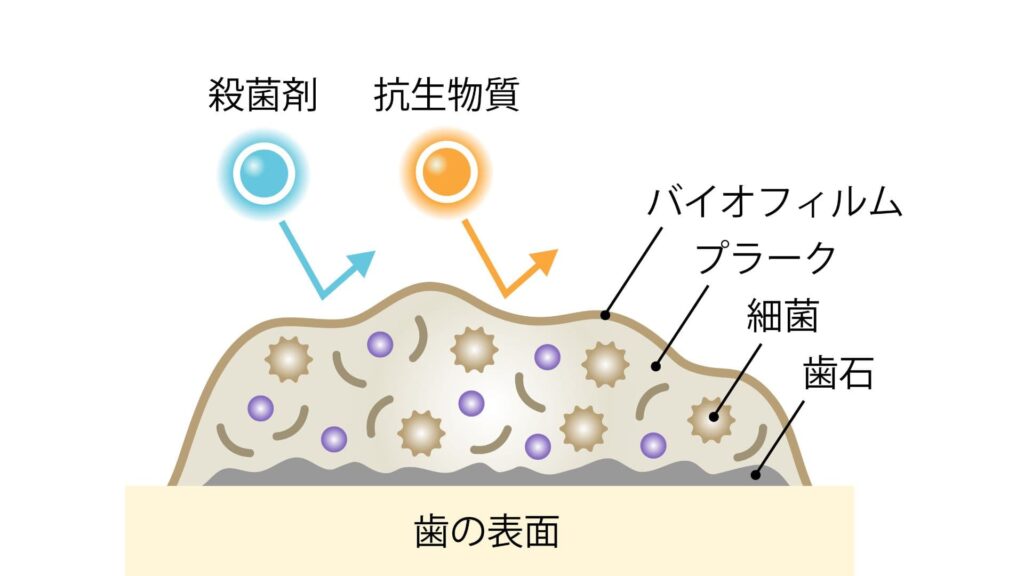 プラークや歯石