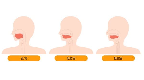 舌の位置
