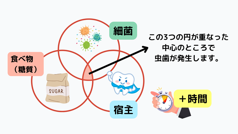 虫歯のメカニズムのイメージ