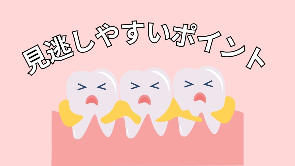 歯肉ポケットのイメージ