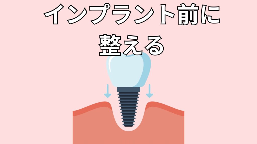 インプラントのイメージ