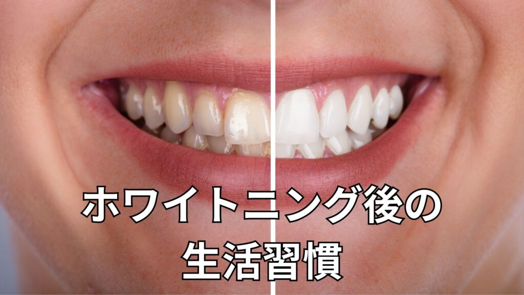 ホワイトニングのビフォーアフター