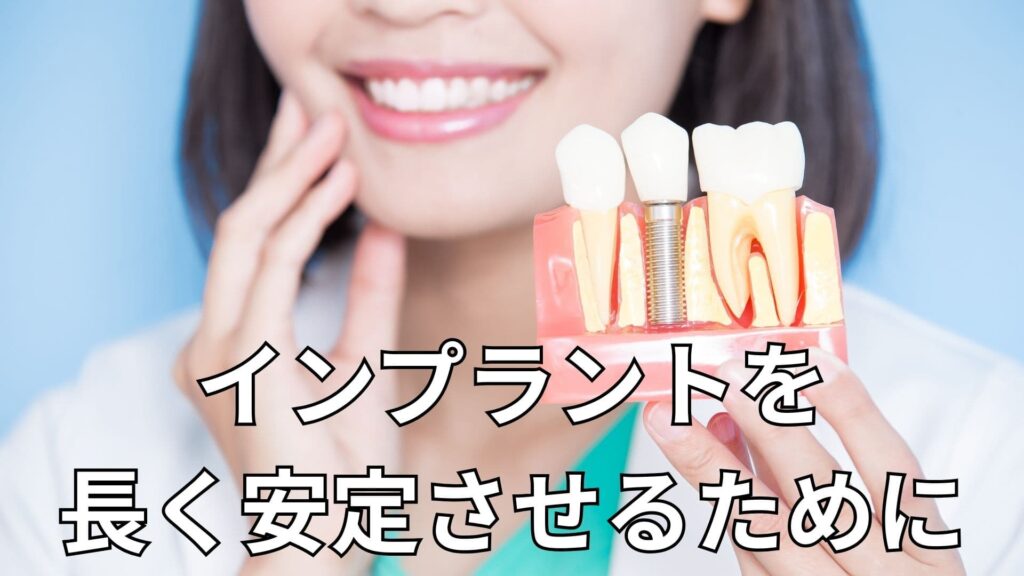 インプラントの模型を持った女性