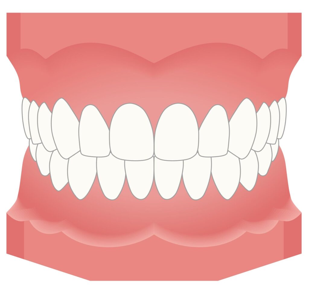 嚙み合わせのイメージ