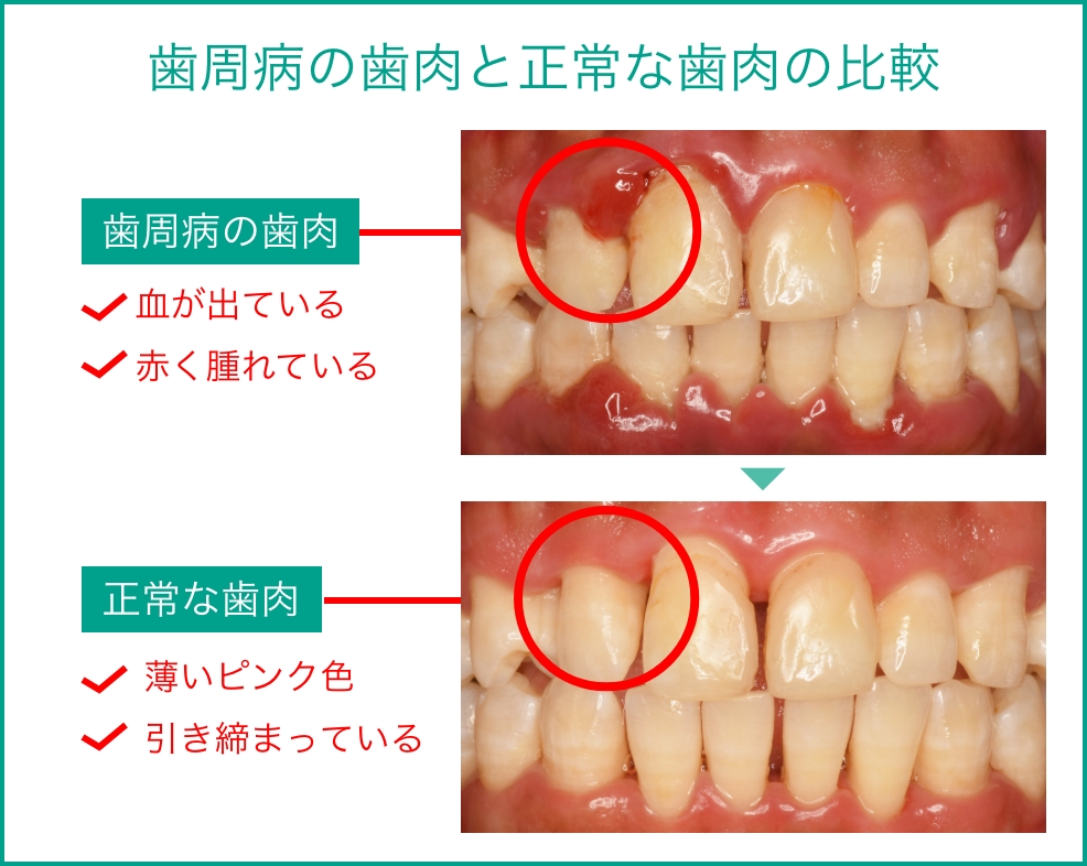どのように診断されるのでしょうか?