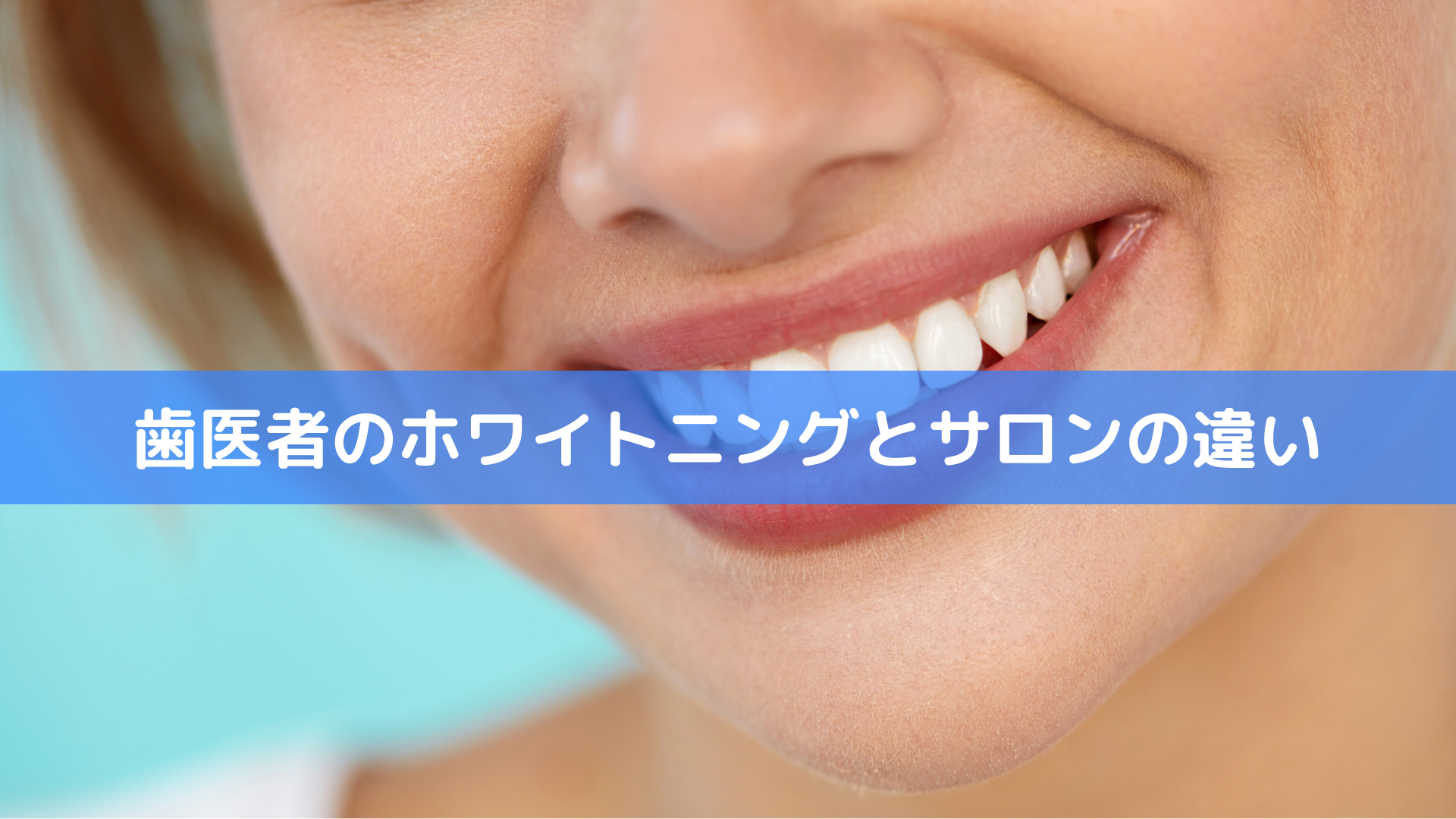コラム え…知らなかった！？歯医者のホワイトニングとサロンの違い