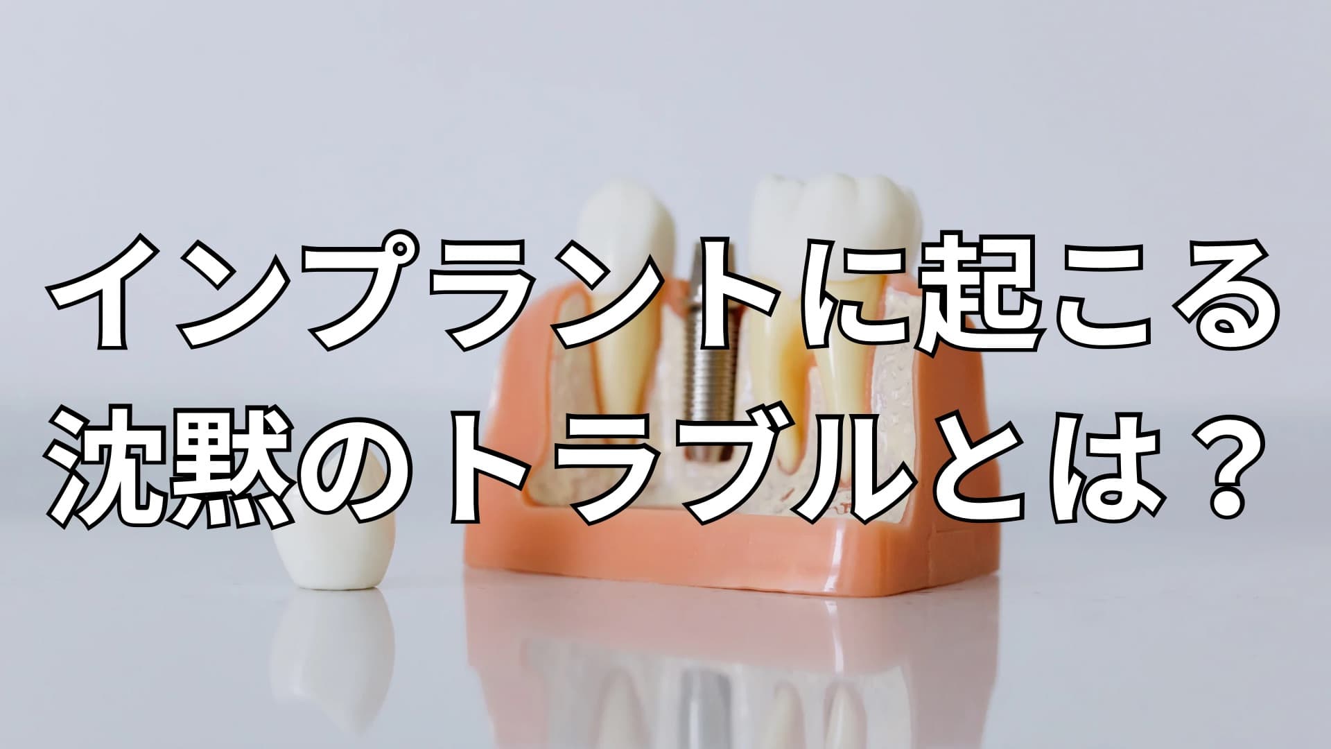インプラントの模型