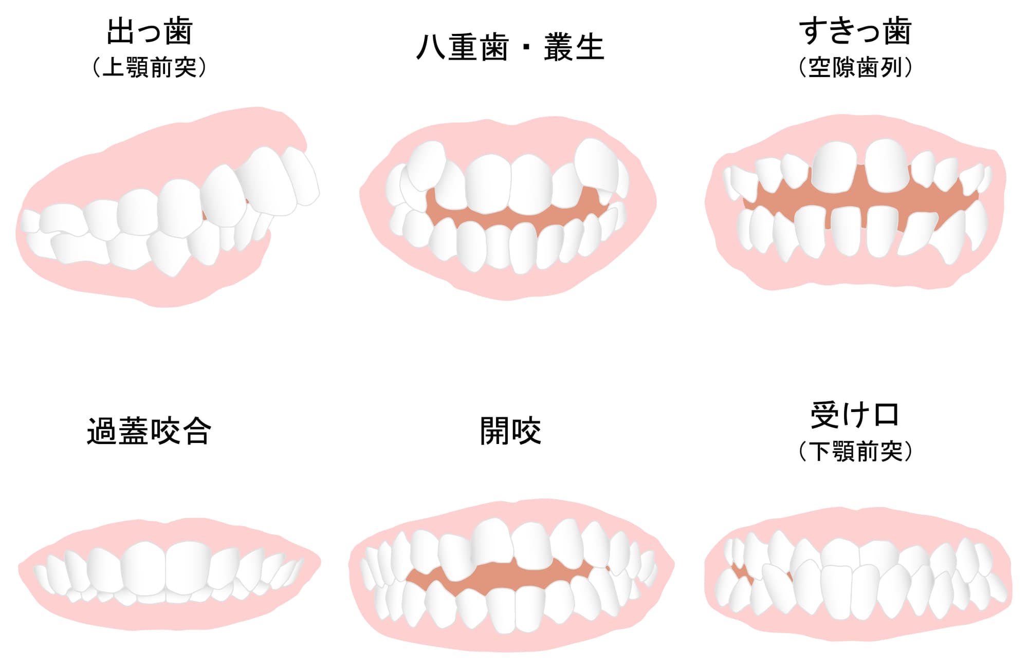 pixta_75565490_M-1.jpg